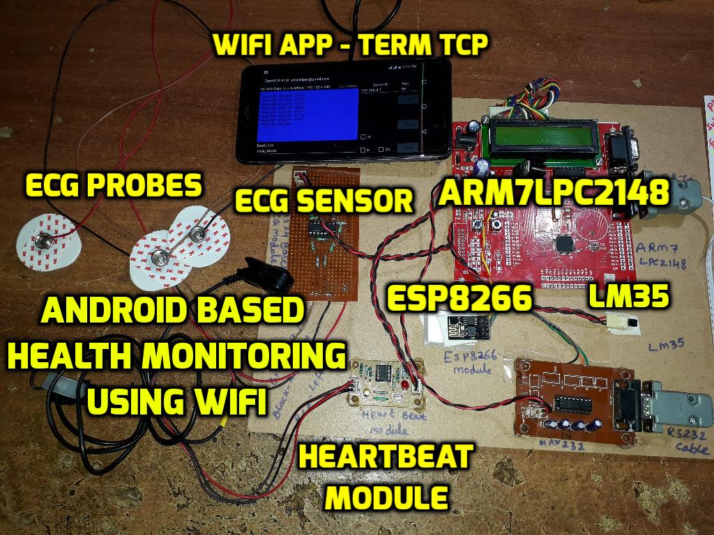 svs_embedded